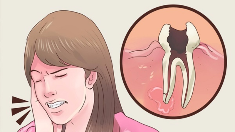 Imagen: Dental Pain Relief. Dr Nepal - YouTube.